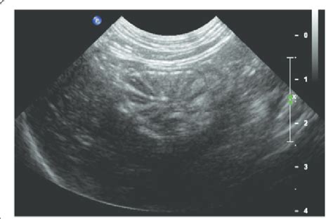 cat stomach ultrasound diagram